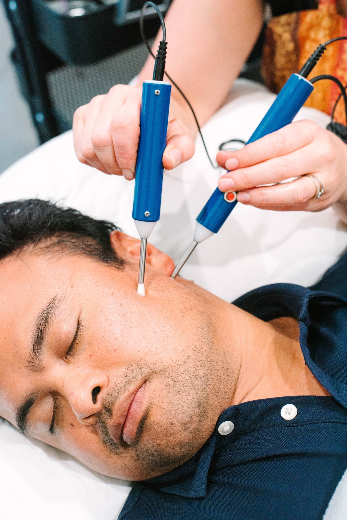 Microcurrent Facial Rejuvenation