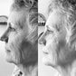 4 Treatments : Client of Gumtree Wellness ~ Murrumbateman Australia  Jennifer is a Raindrop Practitioner, instructor and Aromatherapist in Murrumbateman, Australia     Photos shown in black and white help show the depth of lines and wrinkles easier in a 2D photo format. 